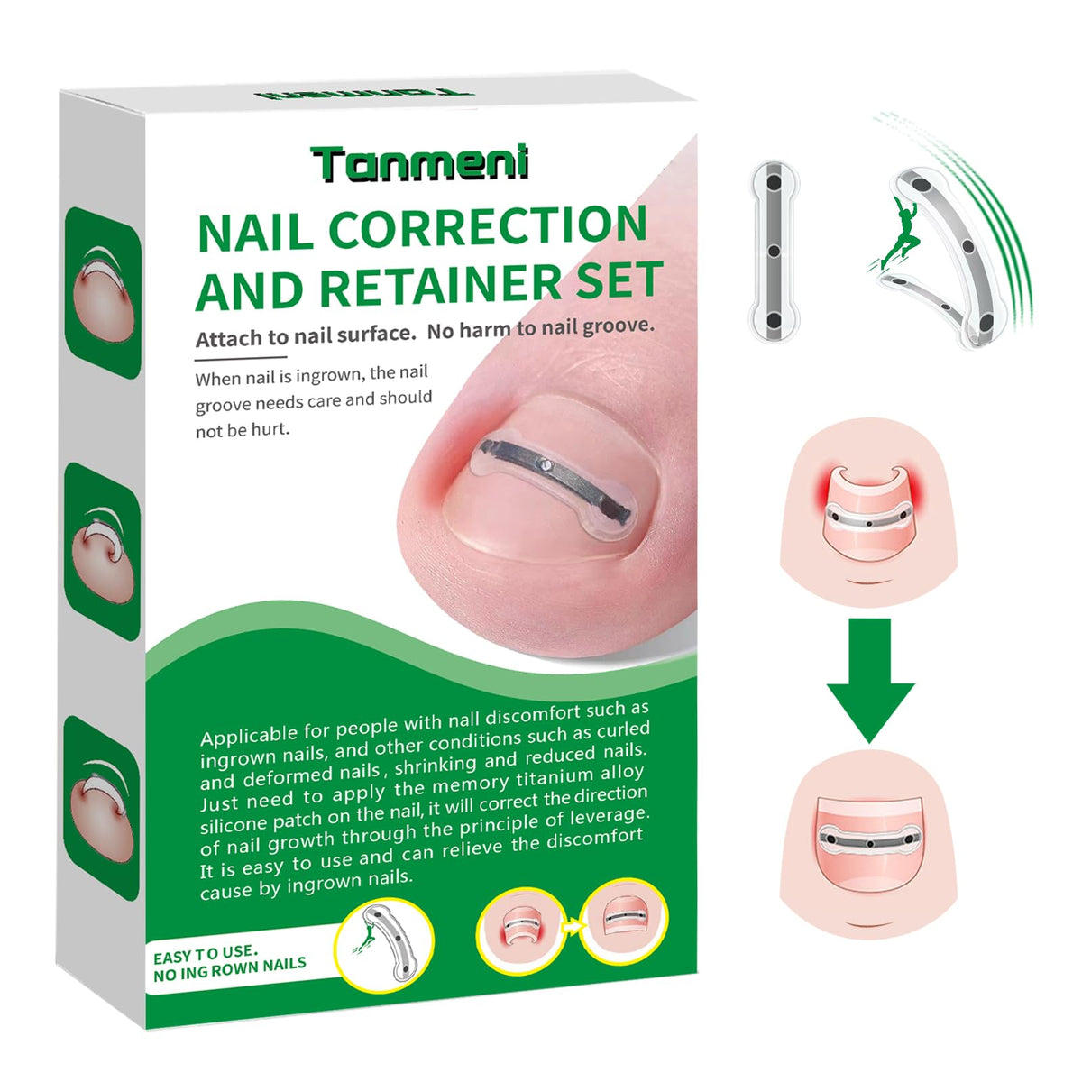 Titanium Alloy Silicone Ingrown Toenail Treatment, Designed for Curved Nail Repair and Ingrown Toenail Corrector,Nail Tools and 