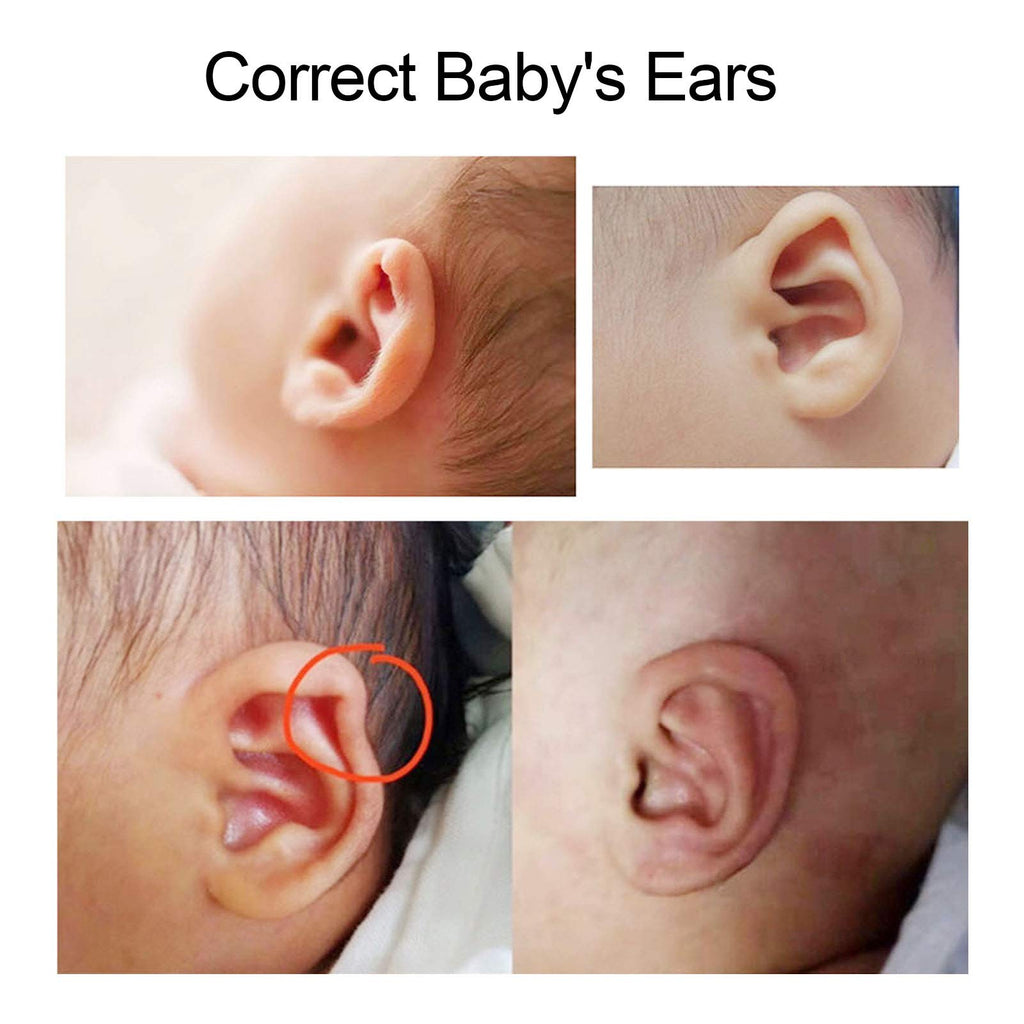Baby Auricle Valgus Correction Patch, Newborn Baby Ear Aesthetic Correctors Kids Infant Protruding Ear Patch Stickers, Children