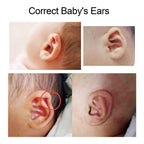 Baby Auricle Valgus Correction Patch, Newborn Baby Ear Aesthetic Correctors Kids Infant Protruding Ear Patch Stickers, Children