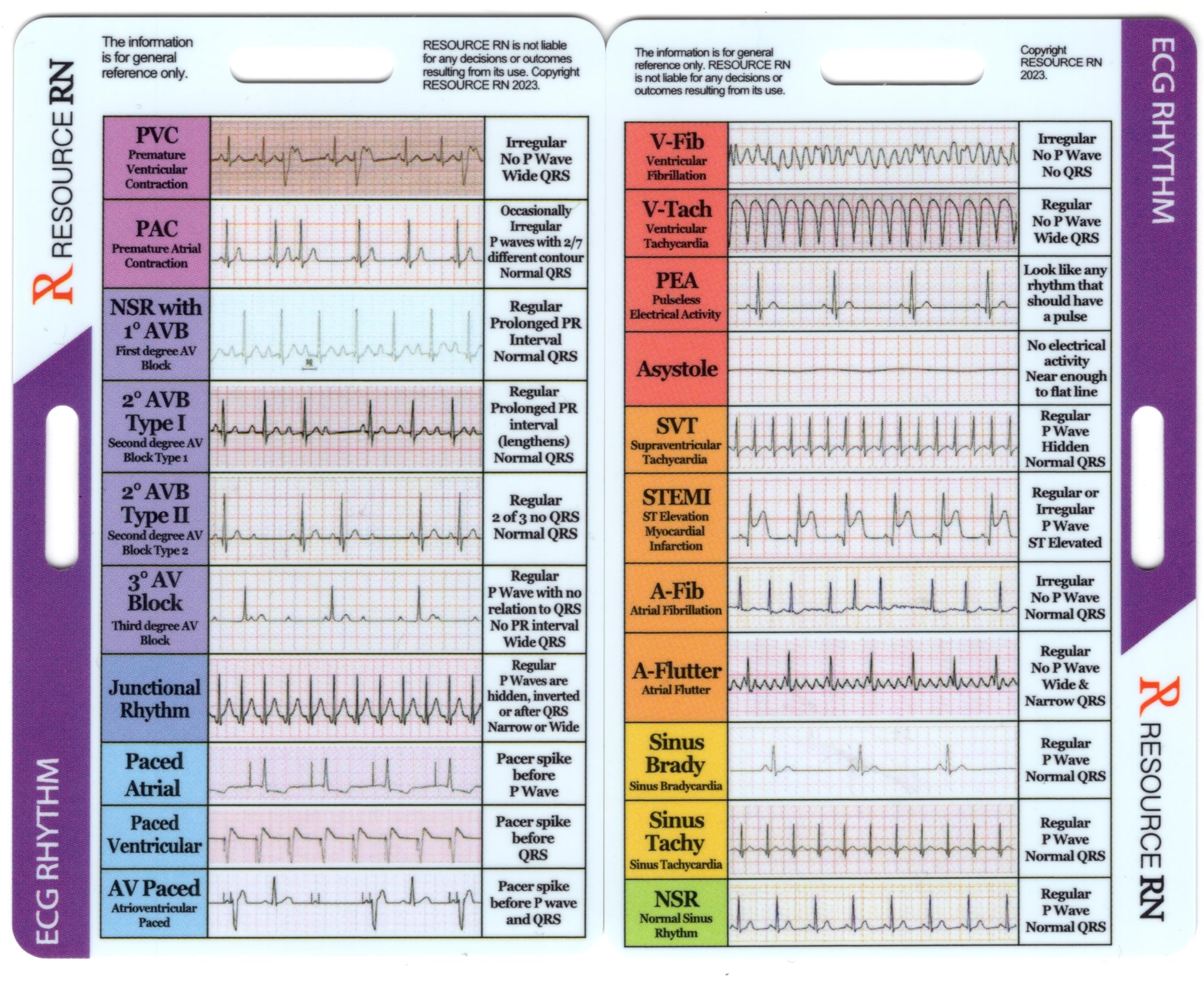 Ekg Rhythm Interpretation - Compact & Portable Reference Card - Rapid Interpretation Guide - Dual Horizontal & Vertical Layout